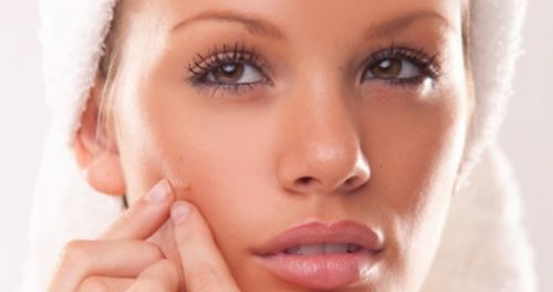 Acne sob controle: 7 dicas para evitar e secar espinhas