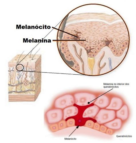 A sensibilidade dos melanócitos e as discromias