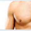 Criolipólise na lipomastia masculina