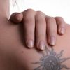 Laser de rubi: técnica é eficaz na remoção de tatuagens