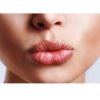 Preenchimento labial: O que é? E quais seus benefícios?