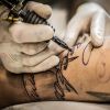 Perguntas e respostas sobre remoção de tatuagem  com laser
