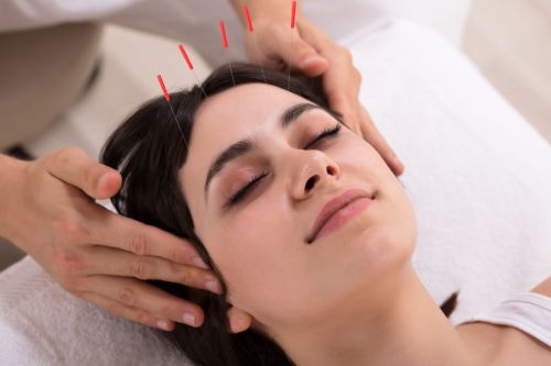 Saiba o que a acupuntura estética pode proporcionar na pele