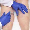 Conheça o procedimento capaz de eliminar os 'vasinhos' das pernas